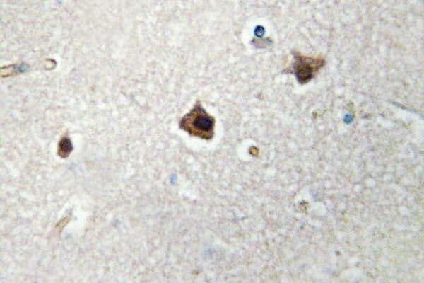 MTA1 Antibody (Lys182)