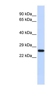 Polyclonal Rabbit anti-Human SOD2 / Mn SOD Antibody (N-Terminus, WB)