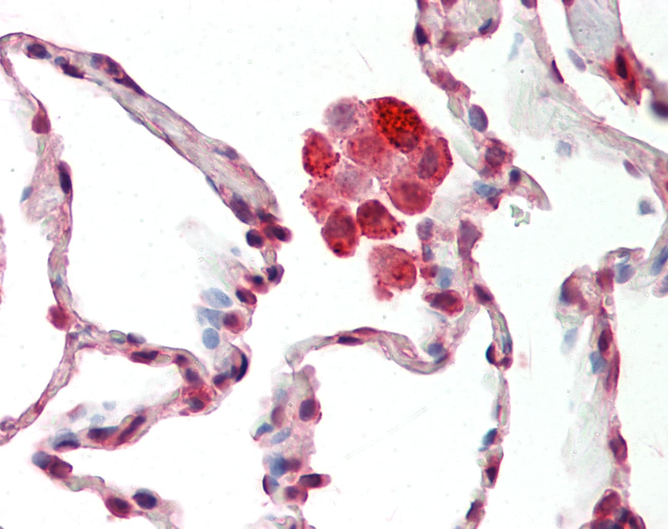 NDUFS8 Antibody (C-Terminus)
