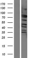 CEP57L1 Protein (Over-Expression Lysate Myc-DDK (Flag))