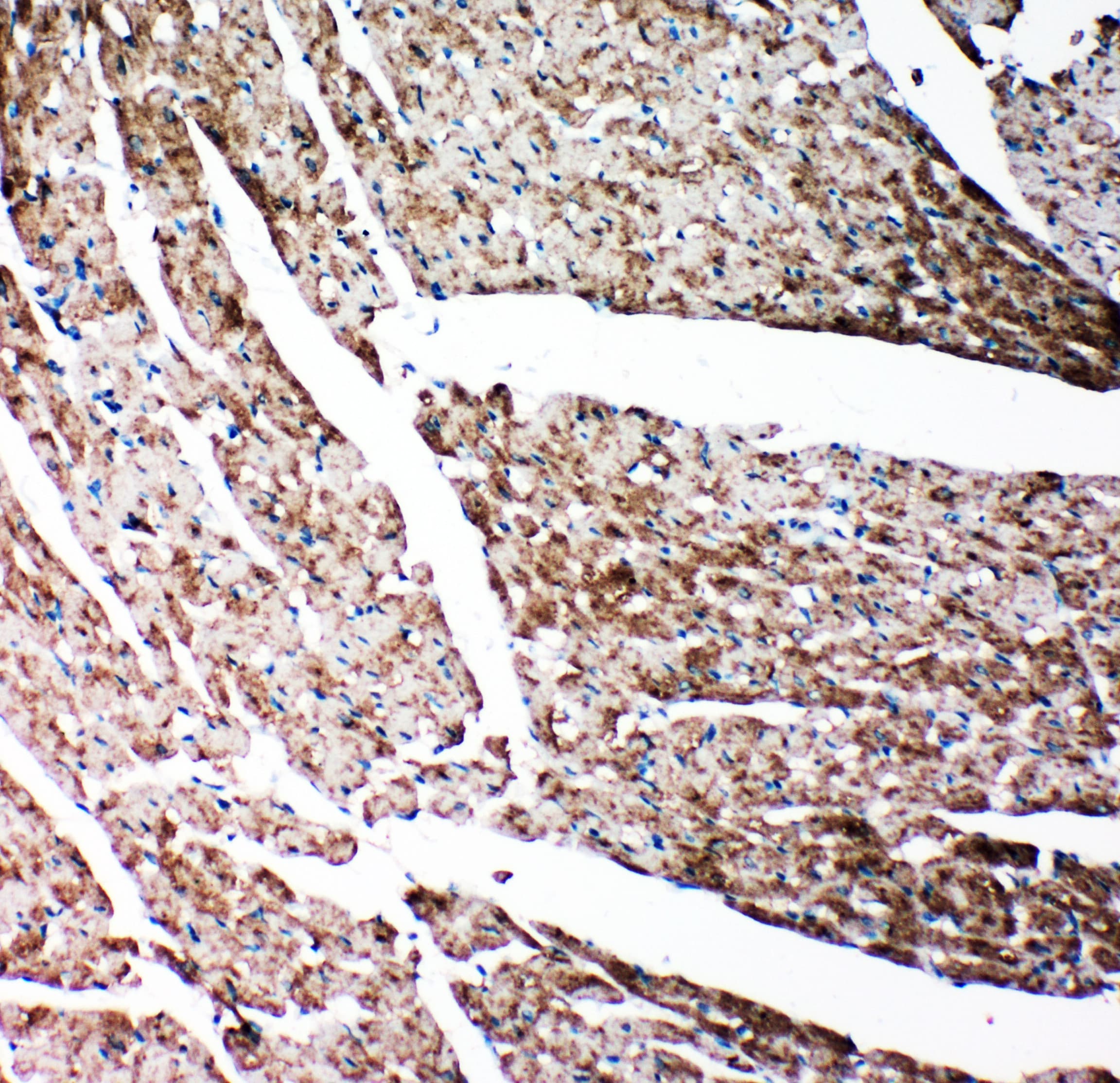GSN / Gelsolin Antibody (aa763-775)