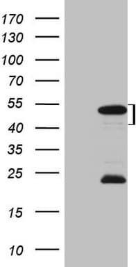 MKX Antibody (clone OTI4H10)