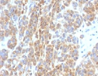 BCL2 / Bcl-2 Antibody (clone BCL2/782, Ready-to-Use)