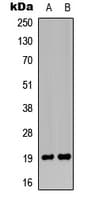 MRPL49 Antibody (Internal)