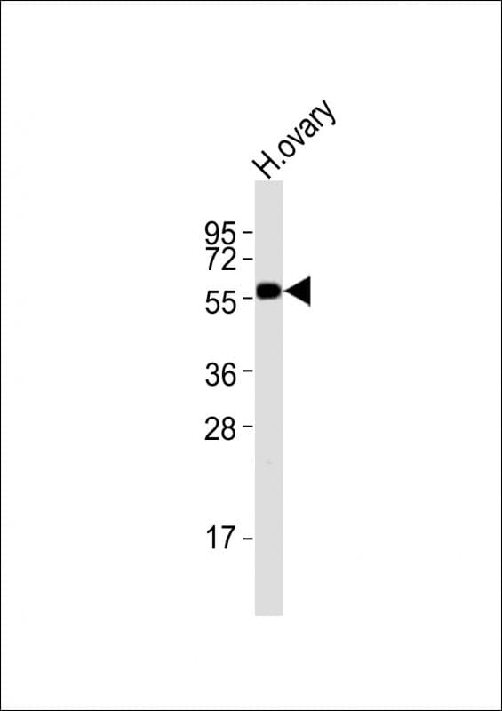 DRD5 / Dopamine Receptor D5 Antibody (aa421-456)