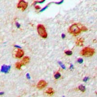 Polyclonal Rabbit anti-Human WAS / WASP Antibody (phospho-Tyr290, IHC, IF, WB)