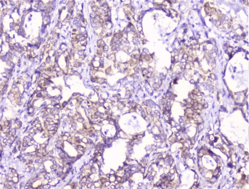 COMP / THBS5 Antibody