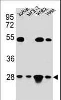 MtTFA / TFAM Antibody (aa216-246)