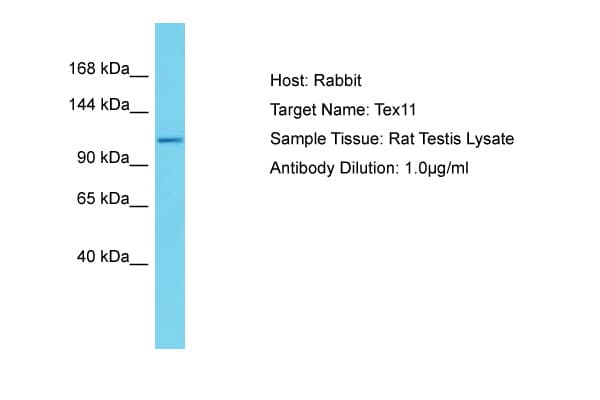 Polyclonal Rabbit anti-Rat TEX11 Antibody (aa39-88, WB)