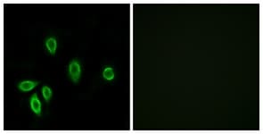 TRH Receptor / TRHR Antibody (aa195-244)