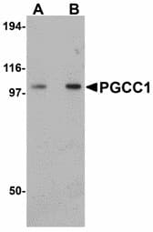 IHC-plus™ Polyclonal Rabbit anti-Human FAM120B Antibody (IHC, WB)