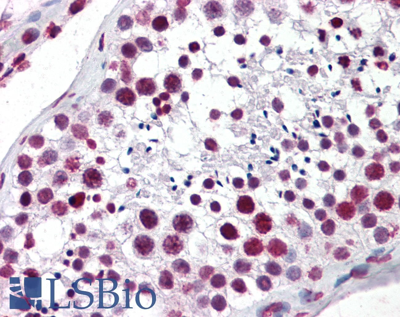 IHC-plus™ AHR Antibody (clone 3B9)