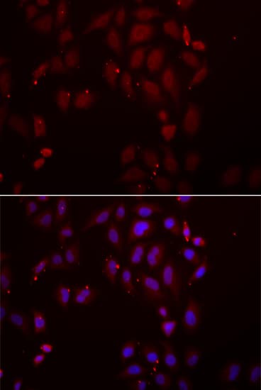 SFRP-3 / FRZB Antibody