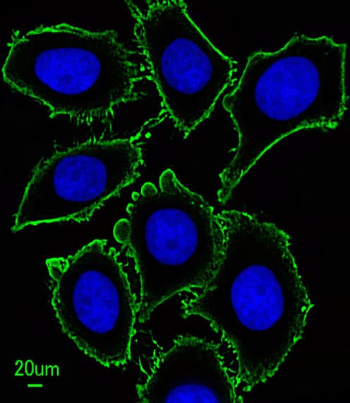 c-Kit / CD117 Antibody