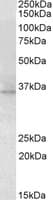 IHC-plus™ RDH1 / RDH5 Antibody (aa19-31)