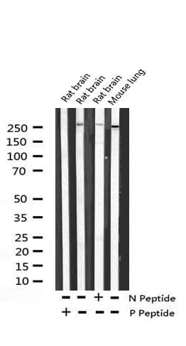 Acetyl-CoA Carboxylase / ACC Antibody (phospho-Ser80)