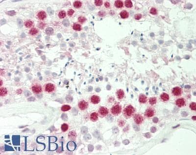 Polyclonal Rabbit anti-Human HIST1H1C Antibody (aa101-150, IHC, WB)