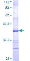 Human TNFAIP2 Protein (Recombinant GST, N-terminus)
