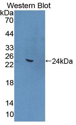 ANGPTL4 Antibody (aa228-389)