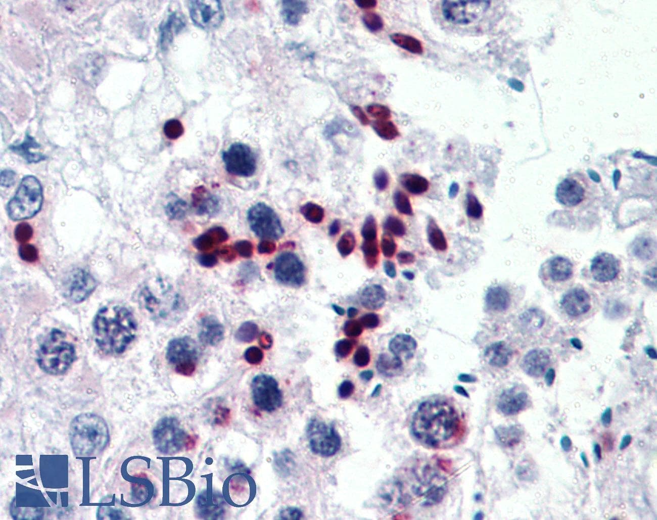IHC-plus™ CGGBP1 Antibody (clone 1D11)