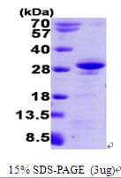 Human RRAS Protein (Recombinant His)