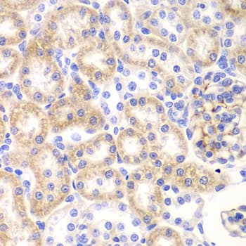 IHC-plus™ SHMT / SHMT2 Antibody