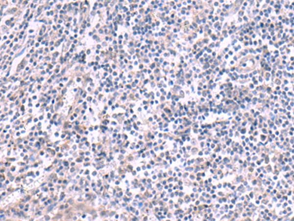 KCNK10 / TREK Antibody