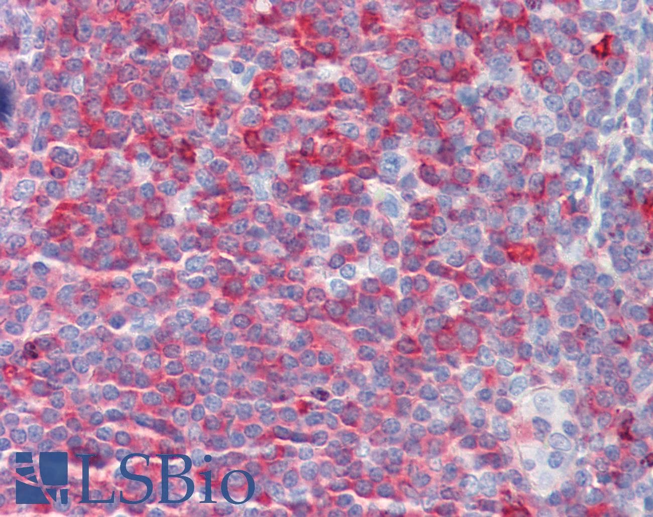 IHC-plus™ Polyclonal Rabbit anti-Human MTOR Antibody (Ser2442, IHC, IF, WB)