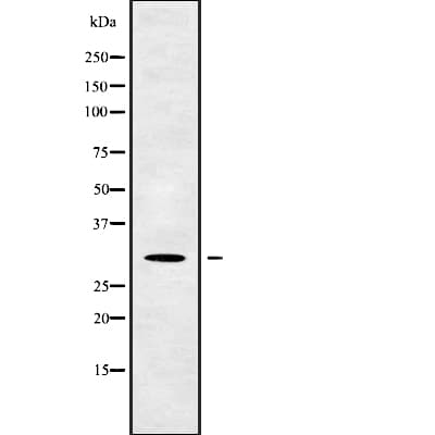 Polyclonal Rabbit anti-Human RFPL4B Antibody (WB)