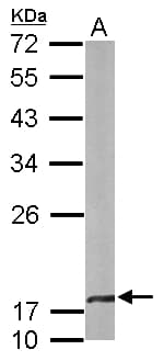 CRYBA4 Antibody (aa1-196)