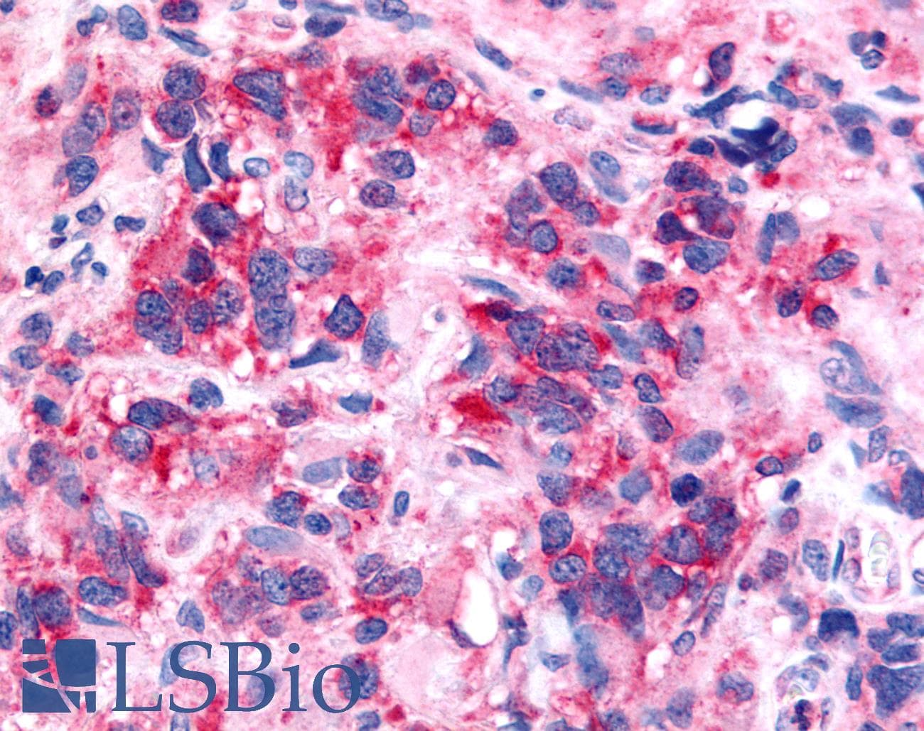 PathPlus™ NTSR2 / NTR2 Antibody (Extracellular Domain)