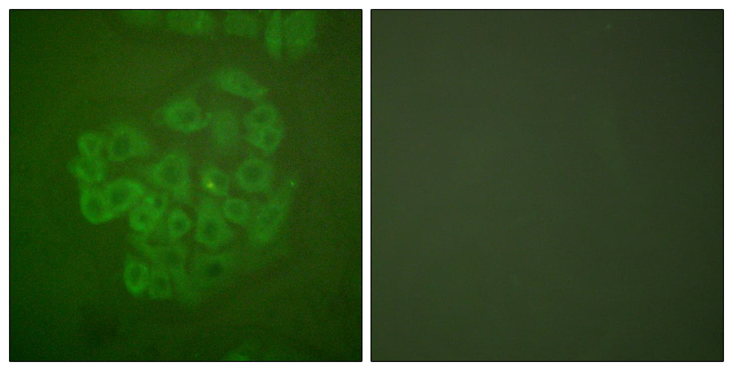 Polyclonal Rabbit anti-Human NR3C1/Glucocorticoid Receptor Antibody (aa181-230, IHC, IF, WB)