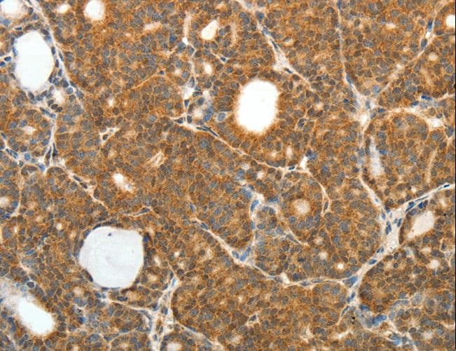 PRDX3 / Peroxiredoxin 3 Antibody