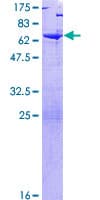 Human TSNAXIP1 Protein (Recombinant GST)