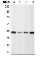 POU4F3 / BRN3C Antibody (C-Terminus)