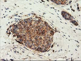 CLPP Antibody (clone OTI1F6, Carrier-free)