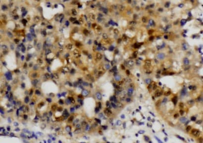 ETS1 / ETS-1 Antibody (Ala32)