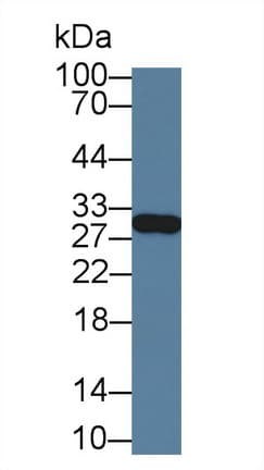 GSTM4-4 / GSTM4 Antibody (aa21-215)