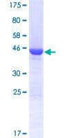 Human COMMD8 Protein (Recombinant GST)