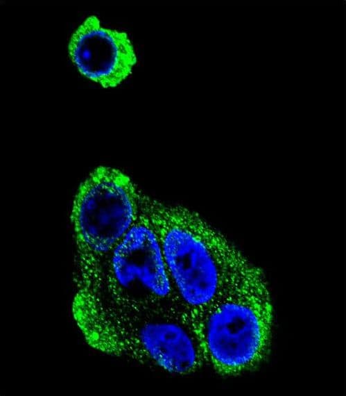 ADH2 / ADH1B Antibody (aa209-237)