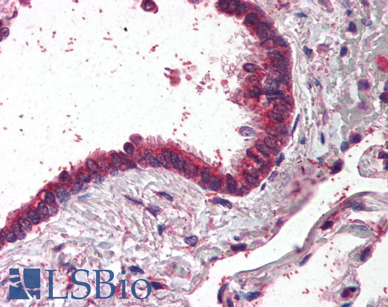 IHC-plus™ AP1G1 / Adaptin Gamma 1 Antibody (aa625-675)