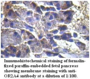 Polyclonal Rabbit anti-Human OR2A4 Antibody (aa31-307, IHC)