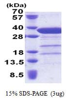 Human STX6 / Syntaxin 6 Protein (Recombinant His)
