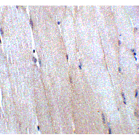 CHADL Antibody