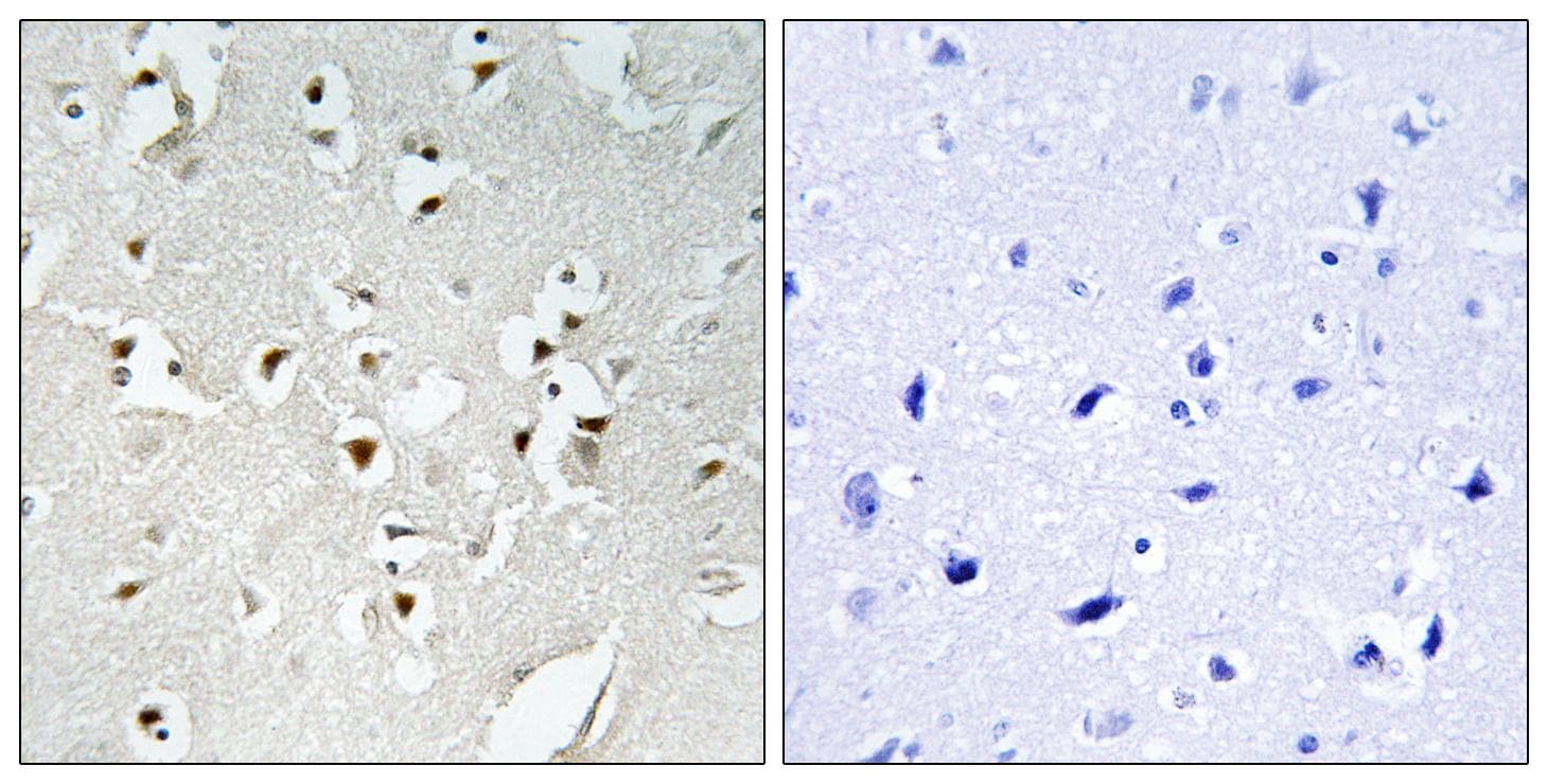 HPMS1 / PMS1 Antibody
