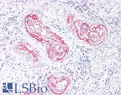 IHC-plus™ Polyclonal Rabbit anti-Human COL5A2 / Collagen V Alpha 2 Antibody (IHC)