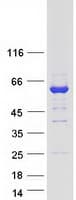 Human FSD1 Protein (Recombinant Myc-DDK (Flag))