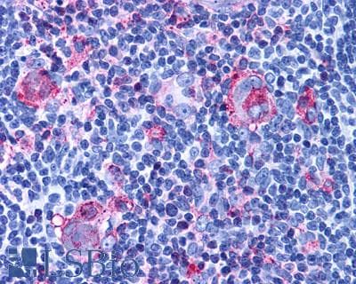 PathPlus™ Polyclonal Rabbit anti-Human CXCR3 Antibody (C-Terminus, IHC)