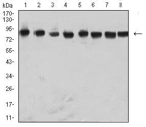 HNRPM / HNRNPM Antibody (clone 5G6C11)