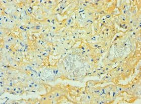 TTBK2 Antibody (aa1185-1244)